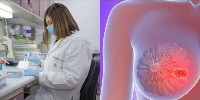 Comienza ensayo en humanos de nueva vacuna contra cáncer de mama