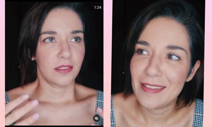 Daniela Alvarado se inyectó baby bótox y así le quedó la cara