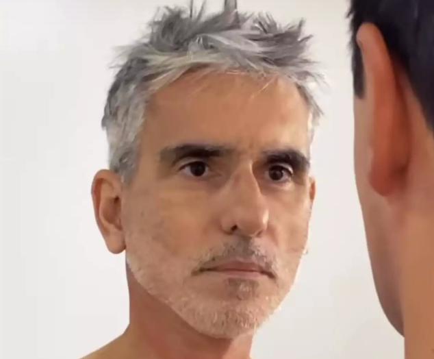 Actor Miguel Varoni mostró el resultado de su cirugía plástica: ¿Si quedó parecido a Maluma?