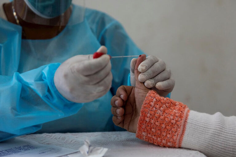 Carabobo, Mérida y Yaracuy con más casos de covid-19