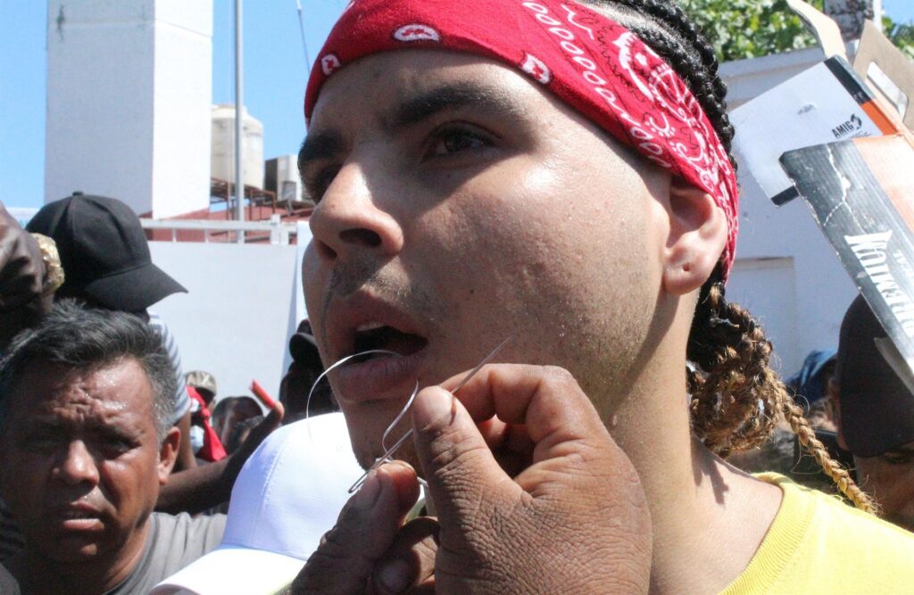 Migrantes se cosen los labios con aguja e hilo para presionar la emisión de visas