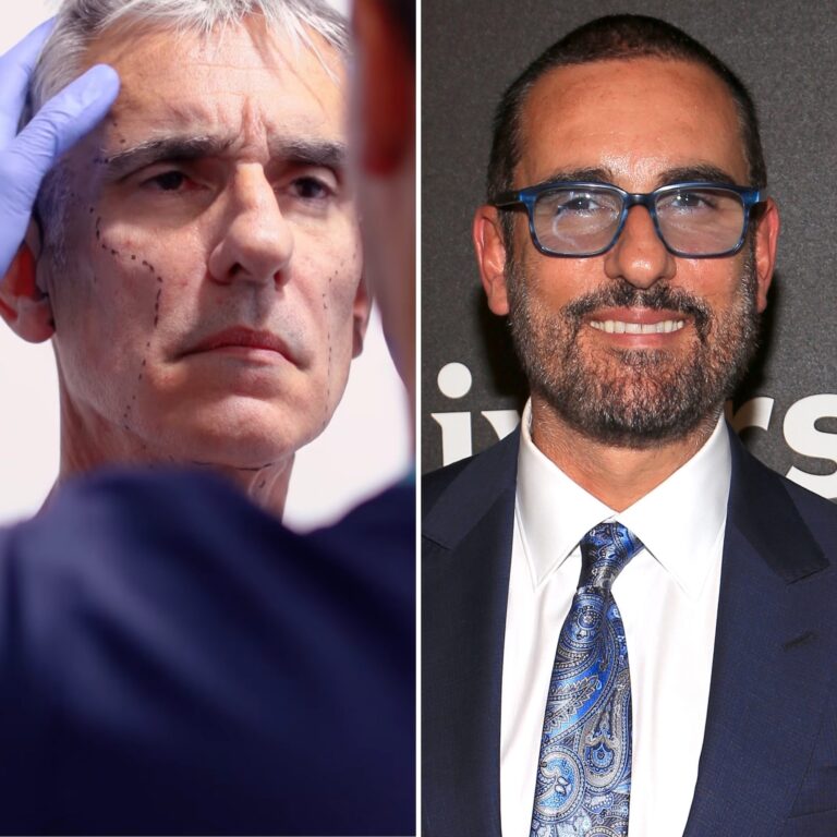 El rejuvenecimiento facial y corporal que se hizo Miguel Varoni, “Pedro el escamoso”