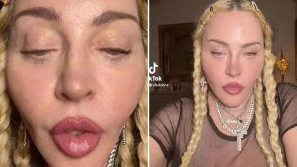 Madonna preocupa a sus fanáticos por su aspecto físico