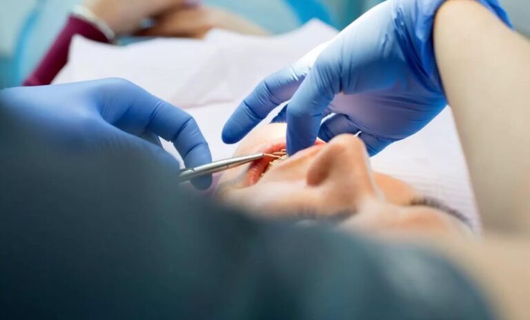 Detenido sujeto que ejercía ilegalmente como ortodoncista sin permisos sanitarios ni formación universitaria