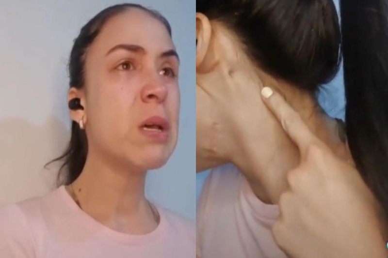 La historia Andrea Suárez, la joven venezolana que estuvo a punto de morir a manos de quien creía amigo