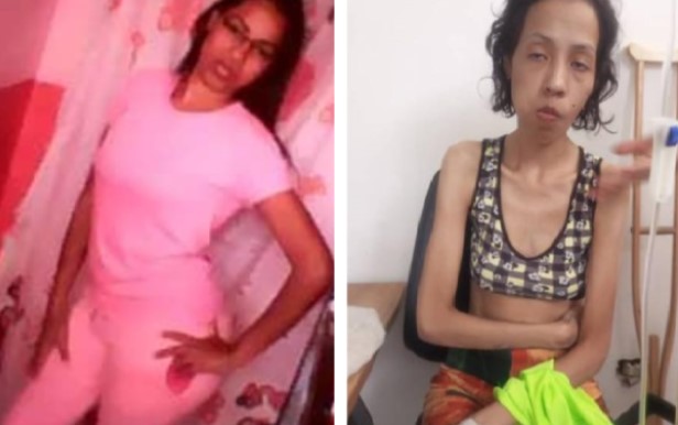 Reclusa de la cárcel de Tocuyito murió por desnutrición y tuberculosis