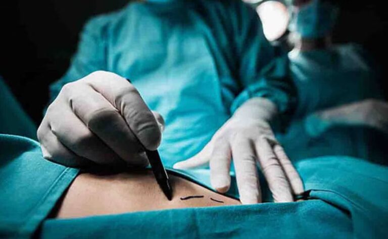 Mujer de 46 años muere por complicaciones al practicarse liposucción en clínica clandestina