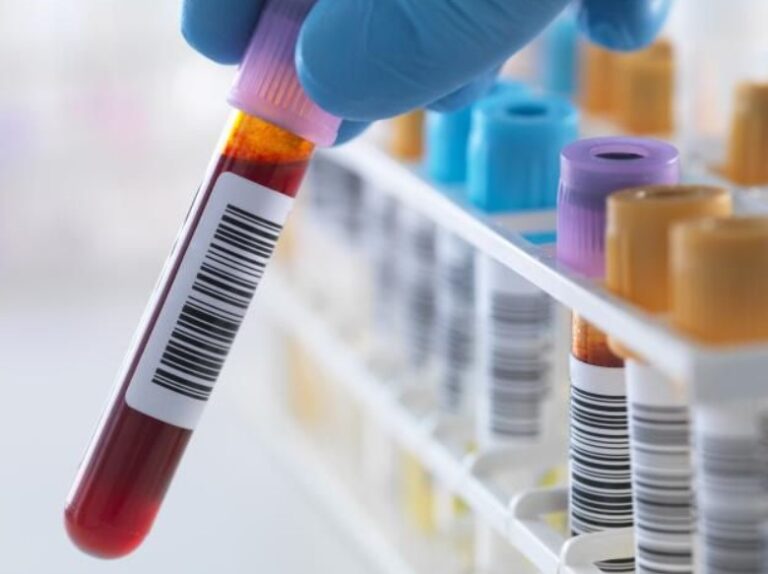 Ante sospecha de embarazo, esto es lo que debe pagar una mujer en Venezuela para saber si está en estado