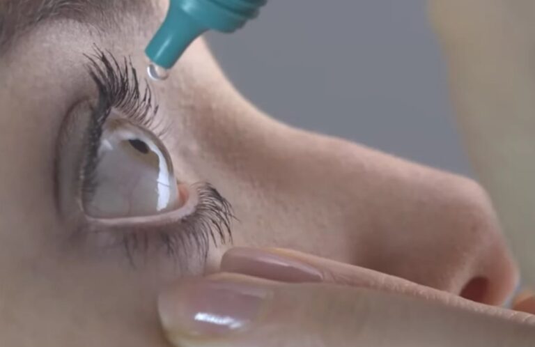 Mujer selló accidentalmente sus ojos con pegamento al pensar que eran gotas refrescantes