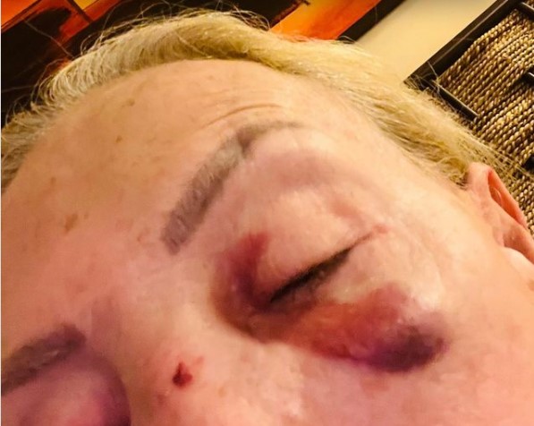 "Soy muy buena para defender a las mujeres y muy mala para defenderme a mí", Laura Bozzo sobre su crisis de ansiedad