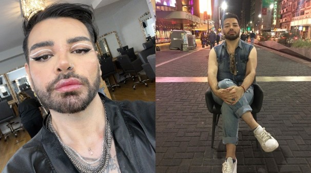 Las secuelas que sufre un hombre por su obsesión de parecerse a Ricky Martín