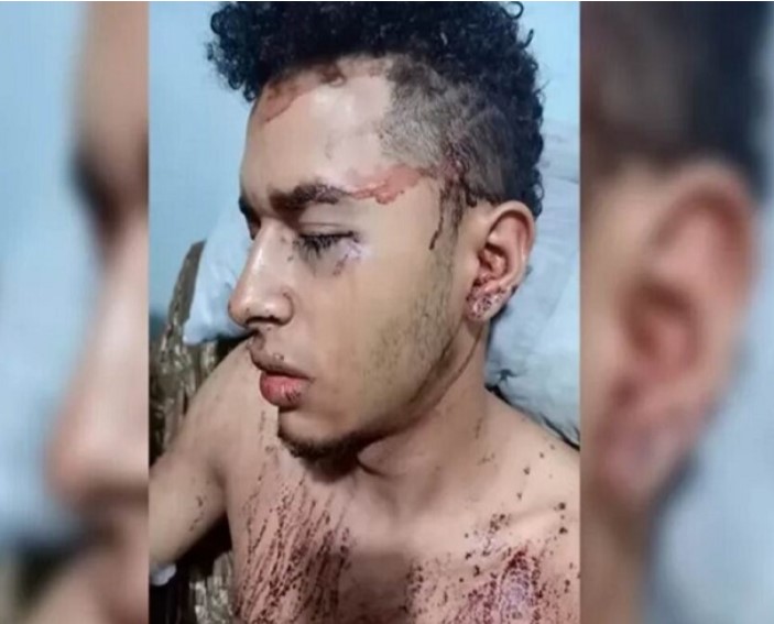 Venezolano fue apuñalado por reclamar a sujetos que orinaron su moto