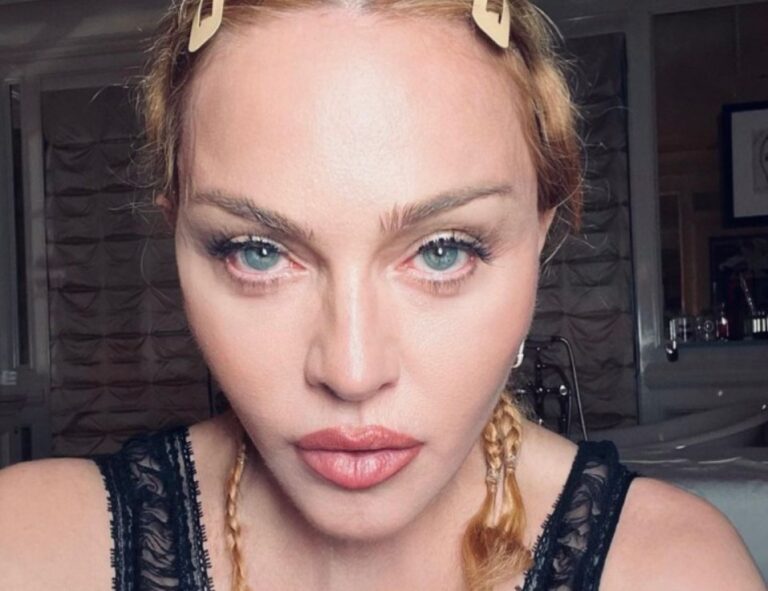 Madonna se recupera de una infección severa que la llevó hasta la UCI