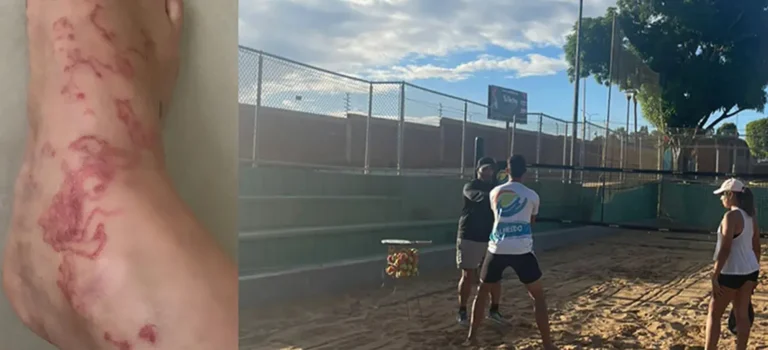Usuarios denuncian que contrajeron parásito por falta de mantenimiento en canchas de beach tennis