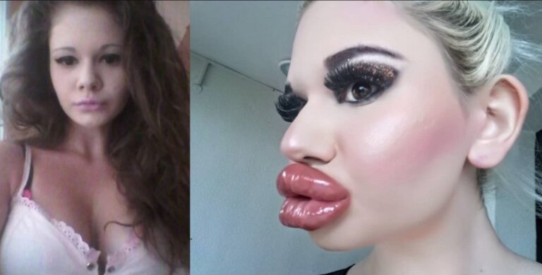 Mujer con los labios más grandes del mundo busca quien la quiera