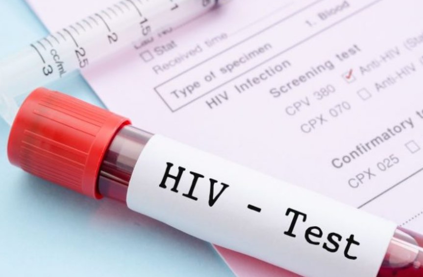 Sexto paciente muestra signos de remisión del VIH después de trasplante de médula ósea