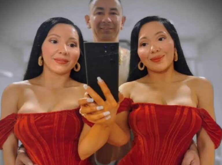 El caso de las gemelas que comparten todo, hasta su pareja