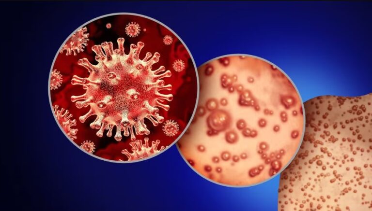 ¿De qué se trata el virus de Alaska que enciende las alertas en Estados Unidos?