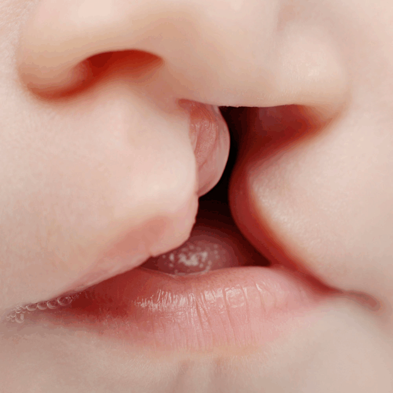 Fundación de la Familia Tachirense coordinó 11 cirugías infantiles de Labio Palatino y 3 Otoplastias