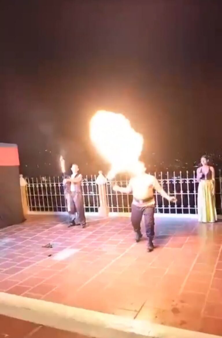 Sufrió quemaduras en su rostro durante espectáculo en Ocaña