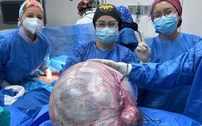 Extraen tumor de 25,5 kilos en el Hospital Razetti de Barcelona