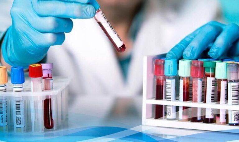 Persiste el 80 % de la falta de insumos en los laboratorios públicos